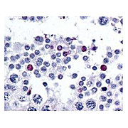 Anti-SPANX-C (RABBIT) Antibody, 500µg, Lyophilized