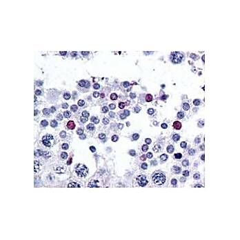 Anti-SPANX-C (RABBIT) Antibody, 500µg, Lyophilized