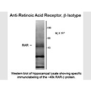 Anti-Retinoic Acid Receptor beta (Mouse) Monoclonal Antibody, 100µL, Liquid