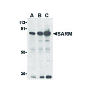 Anti-SARM (RABBIT) Antibody, 100µg, Liquid (sterile filtered)