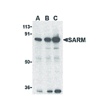 Anti-SARM (RABBIT) Antibody, 100µg, Liquid (sterile filtered)
