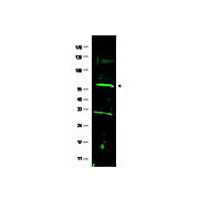 Anti-Human FANCC (RABBIT) Antibody, 100µg, Liquid (sterile filtered)