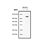 Anti-UPLC1/ASAP3 (RABBIT) Antibody, 100µg, Liquid (sterile filtered)