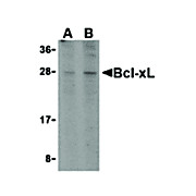 Anti-BCL-xL (RABBIT) Antibody, 100µg, Liquid (sterile filtered)