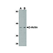 Beta Actin cterm Antibody 100µg