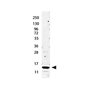 Anti-Human IL-2 (RABBIT) Antibody, 100µg, Lyophilized