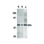 Anti-DR4 (RABBIT) Antibody, 100µg, Liquid (sterile filtered)