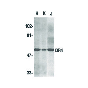 Anti-DR4 (RABBIT) Antibody, 100µg, Liquid (sterile filtered)