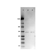 Ready-To-Use Anti-VDAC/Porin (RABBIT) Antibody, 100µL, Liquid (sterile filtered)