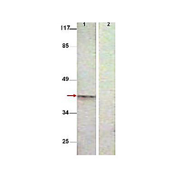 Anti-Aurora B pT232 (RABBIT) Antibody, 25µL, Liquid (sterile filtered)