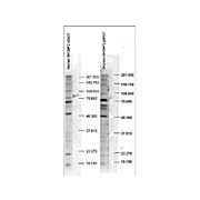 Anti-SH3BP2 pS427 (RABBIT) Antibody, 100µg, Liquid (sterile filtered)