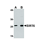 Anti-SIRT6 (CHICKEN) Antibody, 100µg, Liquid (sterile filtered)