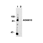Anti-ADAM10 (RABBIT) Antibody, 100µg, Liquid (sterile filtered)