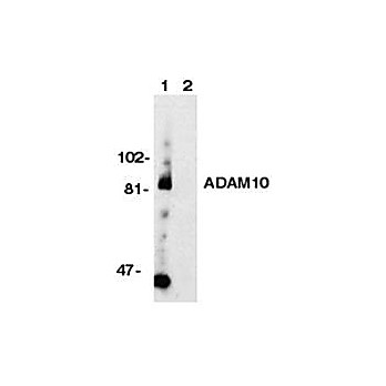 Anti-ADAM10 (RABBIT) Antibody, 100µg, Liquid (sterile filtered)