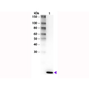 Anti-Human IL-2 (RABBIT) Antibody Biotin Conjugated, 100µg, Lyophilized