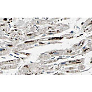 Anti-iASPP (RABBIT) Antibody, 100µg, Liquid (sterile filtered)