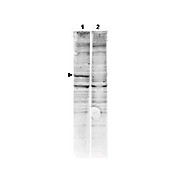 Anti-CaM Kinase II (RABBIT) Antibody, 100µg, Liquid (sterile filtered)