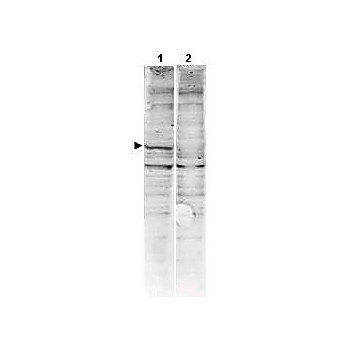 Anti-CaM Kinase II (RABBIT) Antibody, 100µg, Liquid (sterile filtered)