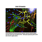 Anti-Vimentin (Chicken) Antibody, 100µL, Liquid