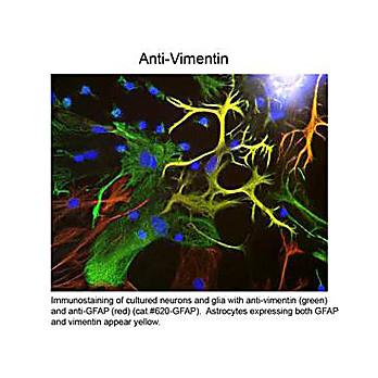 Anti-Vimentin (Chicken) Antibody, 100µL, Liquid