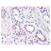 Anti-NFKB p65 (Rel A) pS536 (RABBIT) Antibody, 100µg, Liquid (sterile filtered)