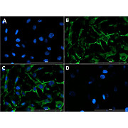 Anti-Collagen Type IV (GOAT) Antibody, 100µg, Liquid (sterile filtered)