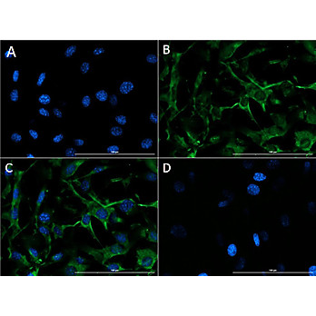 Anti-Collagen Type IV (GOAT) Antibody, 100µg, Liquid (sterile filtered)