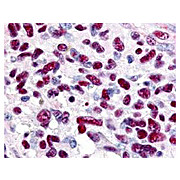 Anti-GLI3 (RABBIT) Antibody, 100µg, Liquid (sterile filtered)