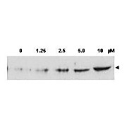 Anti-CHK2 pT68 (RABBIT) Antibody, 100µg, Liquid (sterile filtered)