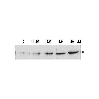 Anti-CHK2 pT68 (RABBIT) Antibody, 100µg, Liquid (sterile filtered)