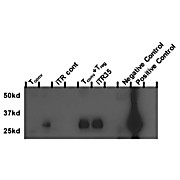 IL-35 EBI3 Biotin Antibody [V14H6] 100µg