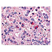Anti-ARTEMIS (DCLRE1C DNA cross-link repair 1C) [GOAT] Antibody, 100µg, Liquid (sterile filtered)