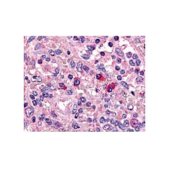 Anti-ARTEMIS (DCLRE1C DNA cross-link repair 1C) [GOAT] Antibody, 100µg, Liquid (sterile filtered)