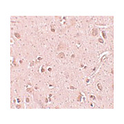 Anti-TINP1 (CHICKEN) Antibody, 100µg, Liquid (sterile filtered)