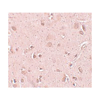 Anti-TINP1 (CHICKEN) Antibody, 100µg, Liquid (sterile filtered)