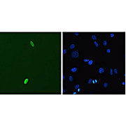 Anti-DUX4 (MOUSE) Monoclonal Antibody, 100µg, Liquid (sterile filtered)