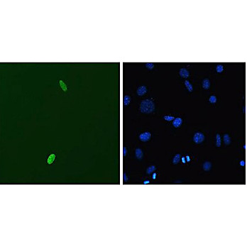 Anti-DUX4 (MOUSE) Monoclonal Antibody, 100µg, Liquid (sterile filtered)