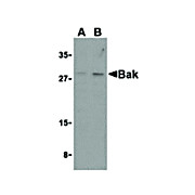 Anti-BAK (RABBIT) Antibody, 100µg, Liquid (sterile filtered)