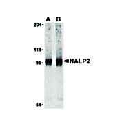 Anti-NALP2 (RABBIT) Antibody, 100µg, Liquid (sterile filtered)