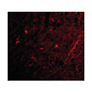 GRIK1 Antibody internal 100µg