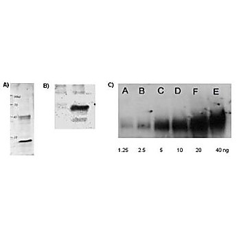 Anti-Lysine Acetylated (AcK) (RABBIT) Antibody, 100µg, Liquid (sterile filtered)