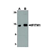 IFITM1 Antibody internal 100µg