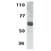 hu Anti-IL-22 Receptor cterm 100µg