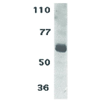 hu Anti-IL-22 Receptor cterm 100µg