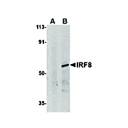 IRF8 Antibody 100µg