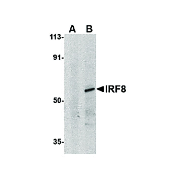 IRF8 Antibody 100µg