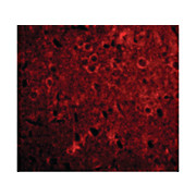 Anti-GPAT1 (RABBIT) Antibody, 100µg, Liquid (sterile filtered)