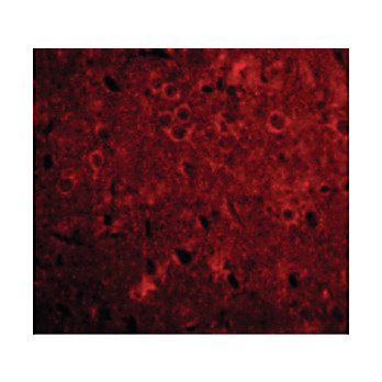 Anti-GPAT1 (RABBIT) Antibody, 100µg, Liquid (sterile filtered)