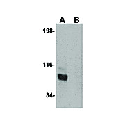 JPH3 Antibody cterm 100µg