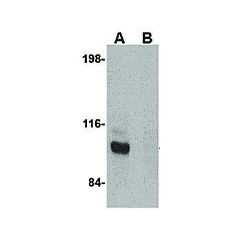 JPH3 Antibody cterm 100µg